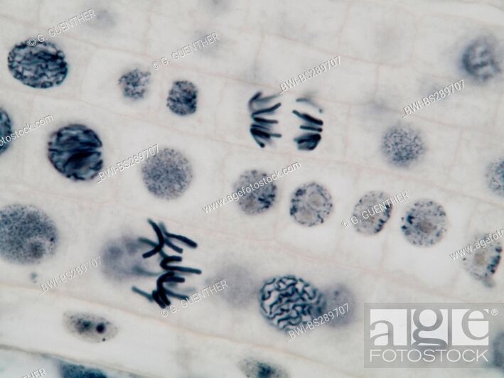 mitosis in a onion root, prophasis and anaphasis, Stock Photo, Picture