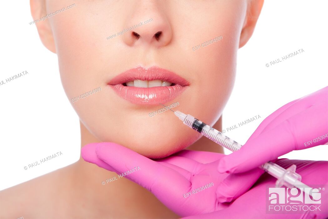 Stock Photo: Beautiful plump lips injection with collagen filler Cosmetic spa beauty treatment with pink gloves, on white.