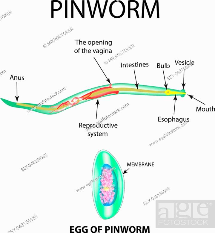 pinworm diagram