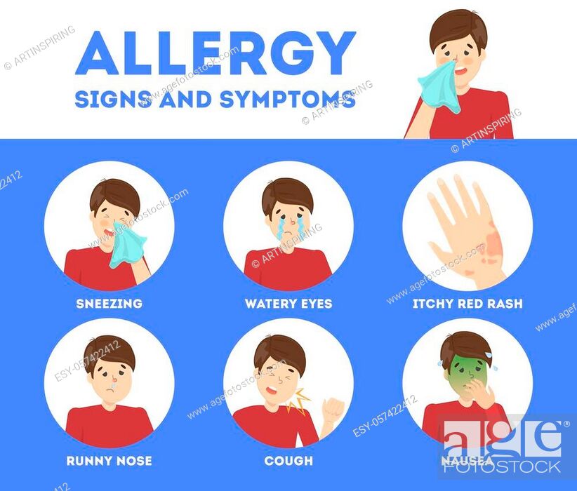 Allergy symptoms infographic. Runny nose and itchy skin. Seasonal disease,  Stock Vector, Vector And Low Budget Royalty Free Image. Pic. ESY-057422412  | agefotostock