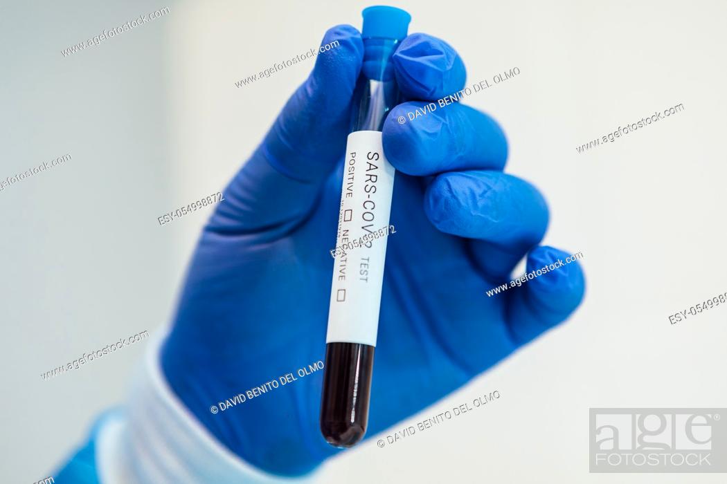 Stock Photo: Hand with blue glove of biologist doctor holds a test tube with blood to test for COVID-19.