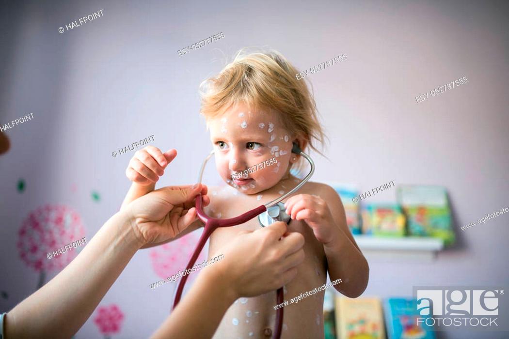 Photo de stock: Little two year old girl at home sick with chickenpox, white antiseptic cream applied to the rash. Mother giving her stethoscope.
