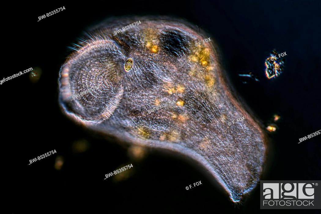 Stock Photo: trumpet animalcules (Stentor spec.), in differential interference contrast.