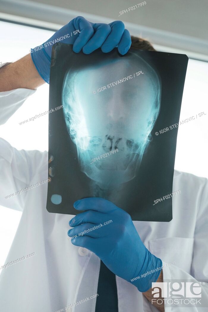 Stock Photo: Doctor examining X-ray of the skull.