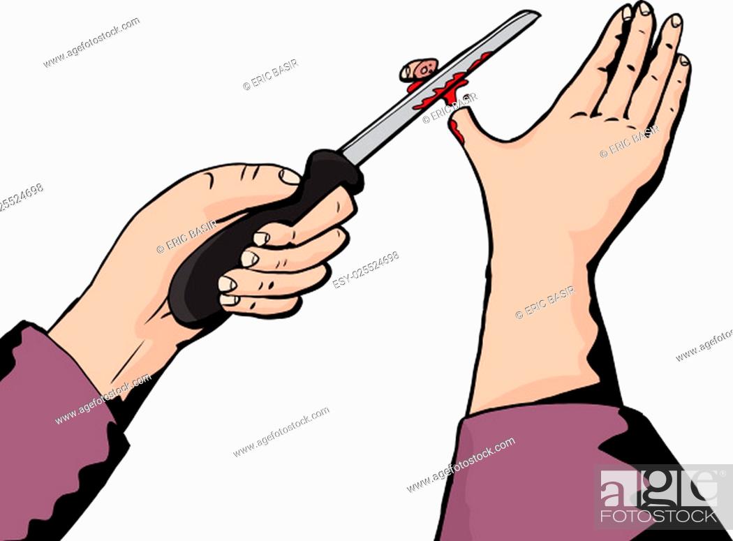 Isolated cartoon of knife cutting thumb tip, Stock Photo, Picture And Low  Budget Royalty Free Image. Pic. ESY-025524698 | agefotostock