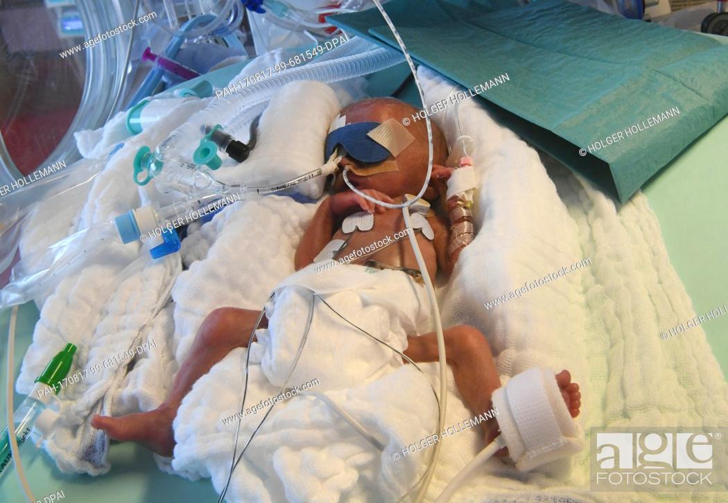 Stock Photo: A 5-day-old boy who weighed 430 grams at birth, in an incubator at the children's clinic of Hannover Medical School (Medizinische Hochschule Hannover.