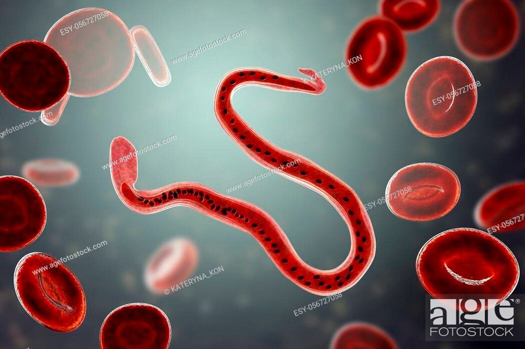 Stock Photo: Wuchereria bancrofti, a roundworm nematode, one of the causative agents of lymphatic filariasis, 3D illustration showing presence of sheath around the worm and.