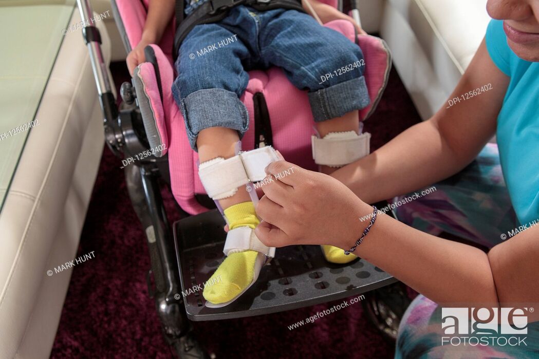 Stock Photo: Mother putting leg brace on small daughter with Cerebral Palsy.