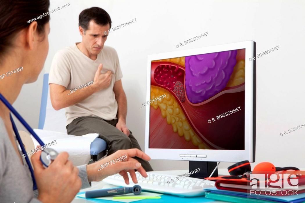Stock Photo: CARDIOLOGY CONSULTATION MAN Models. On screen, drawing representing an artery obstructed following a stenosis caused by the compression of the tumor.