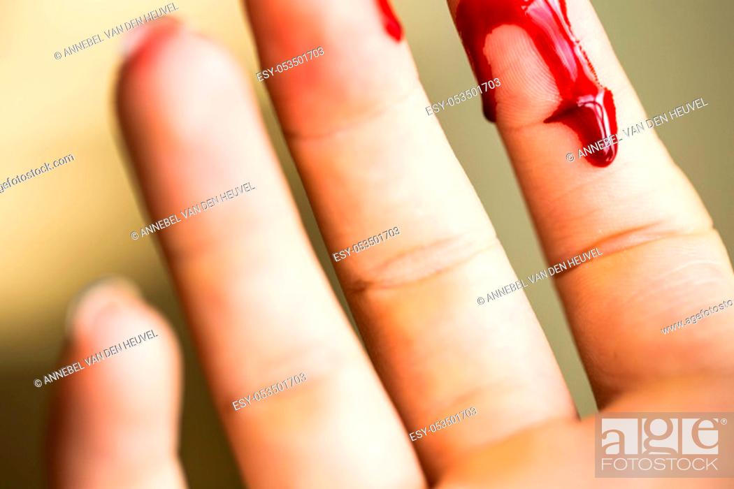 Bleeding blood from the cut finger wound. injured finger with canvas prints  for the wall • canvas prints wounded, woman, white | myloview.com