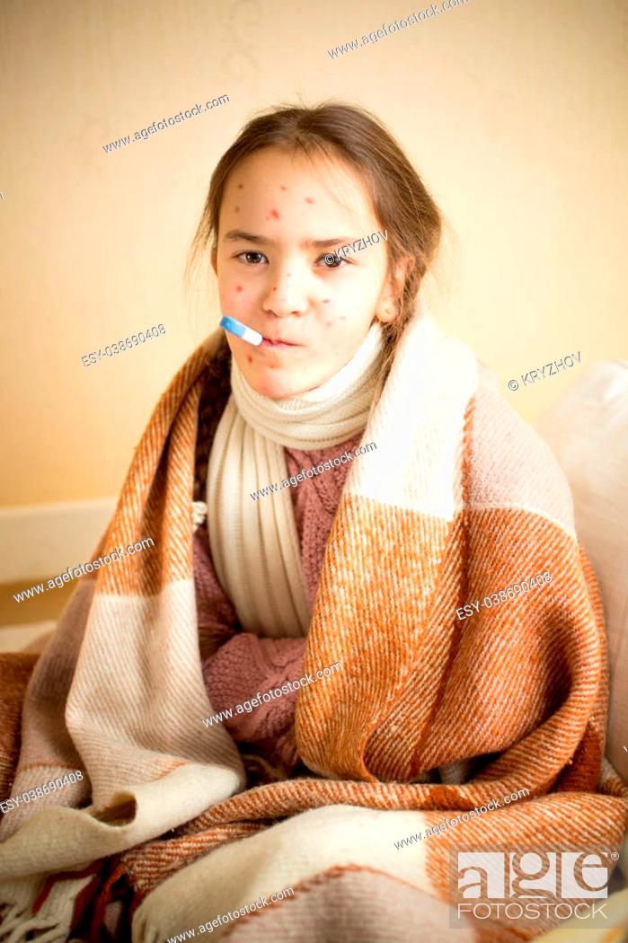 Photo de stock: Portrait of sick girl with chickenpox measuring temperature with mouth thermometer.