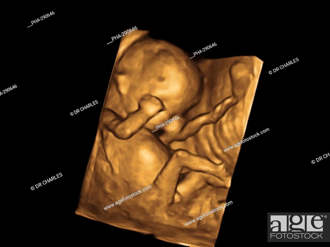 Gestational determine ultrasound age to How does