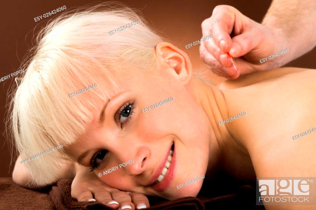 Stock Photo: Close-up Of A Young Woman Receiving Acupuncture Treatment In A Beauty Spa.