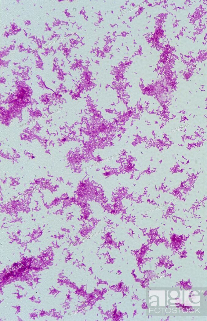 Stock Photo: Salmonella typhi. Bactery of typhoid fever. Gram.
