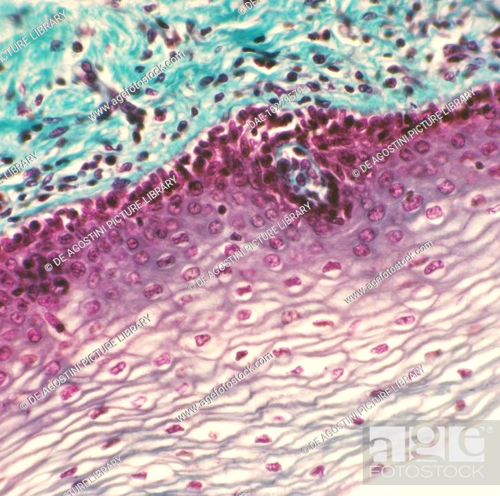 Squamous epithelial cell from a human vagina seen under microscope, at x210 magnification, Stock Photo, Picture And Rights Managed Image. Pic. DAE-10228579 | agefotostock
