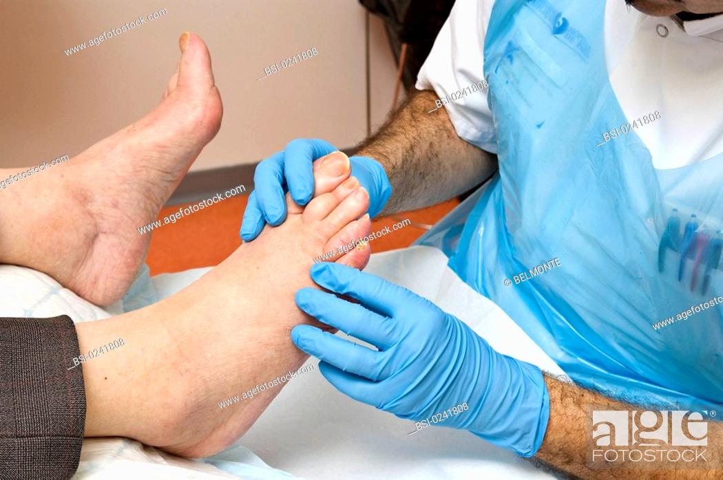 Stock Photo: PEDICURE Photo essay from hospital. Pedicure care at the Corentin Celton hospital Issy-les-Moulineaux, France. Examination of a diabetic patient's feet.