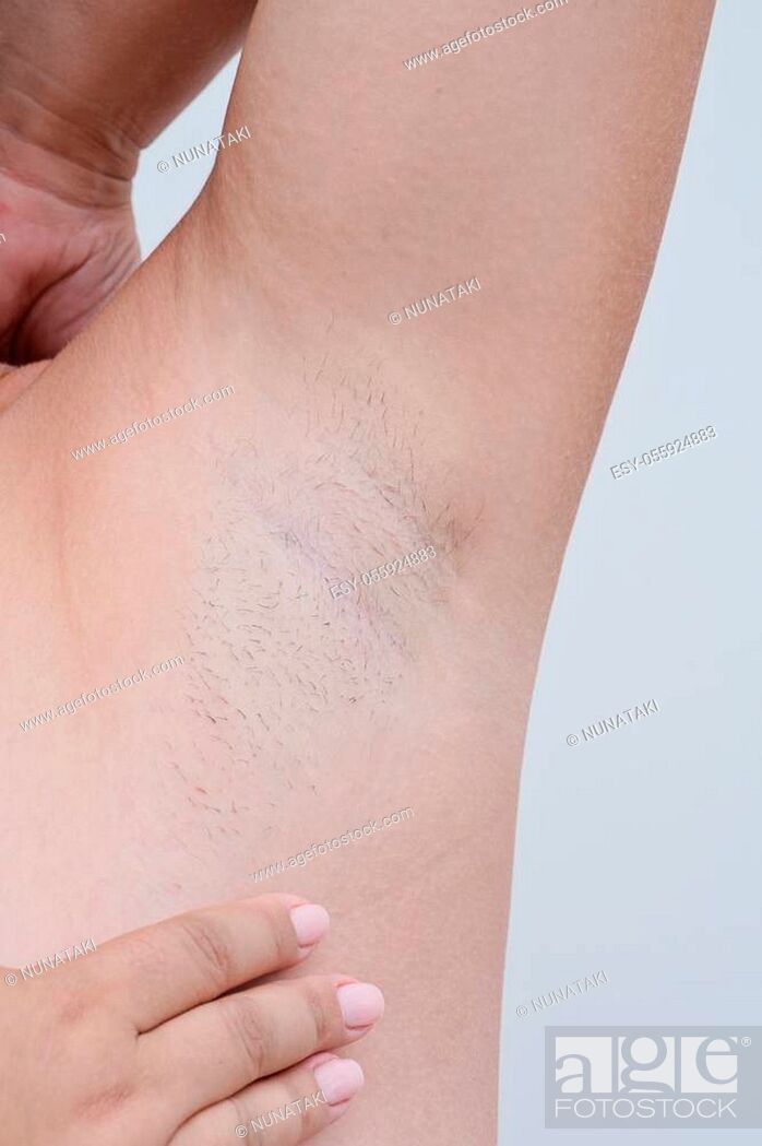 Closeup voew of woman with armpit hair, female hairy armpit, before  shaving, Stock Photo, Picture And Low Budget Royalty Free Image. Pic.  ESY-055924883 | agefotostock