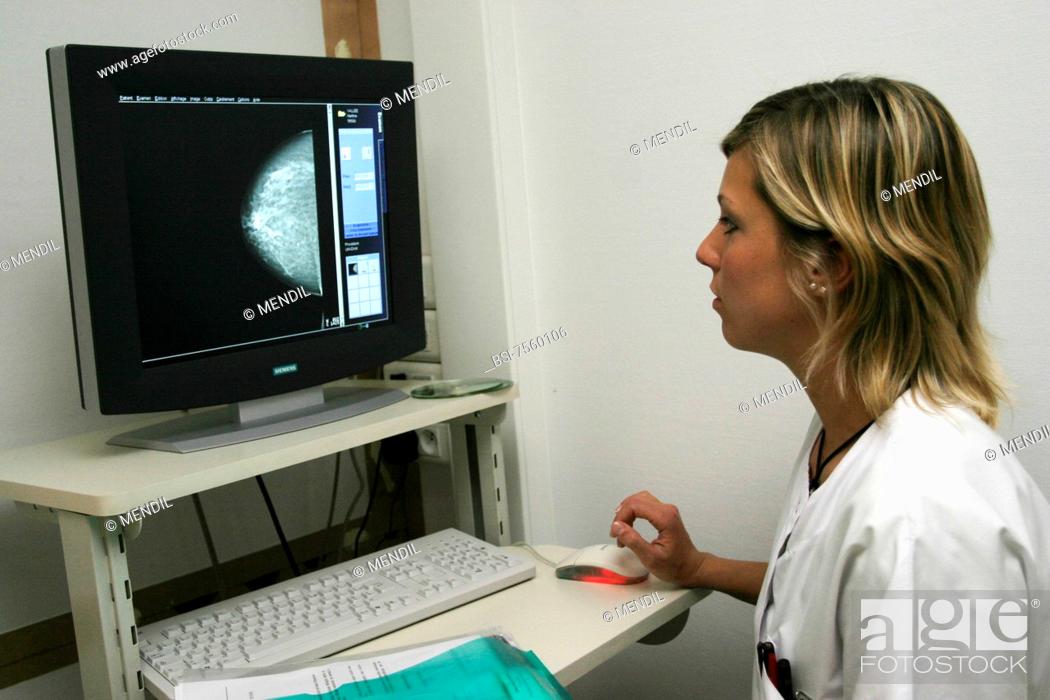 Stock Photo: Photo essay from hospital. Digital mammography. This process brings a much larger image with a better resolution than the regular mammography.
