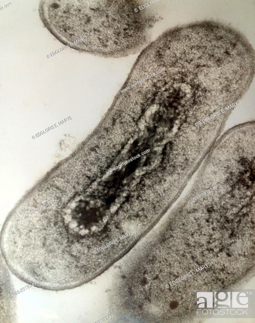 Photo de stock: Cross section of Escherichia coli bacteria under transmission electron microscopy.