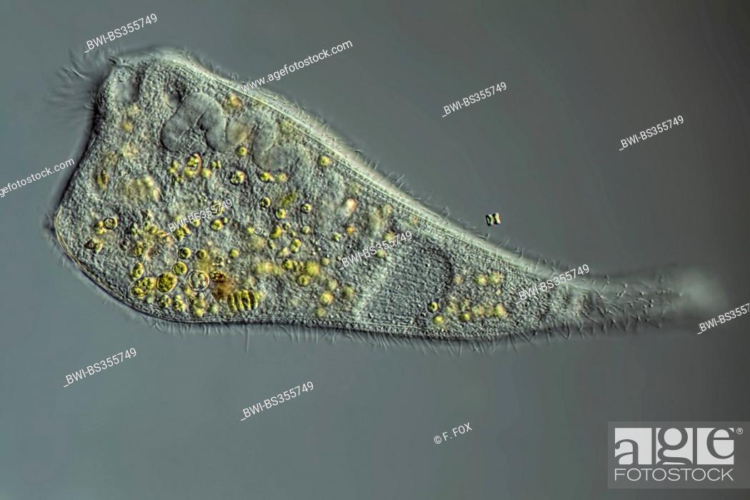 Stock Photo: trumpet animalcules (Stentor spec.), in Differential interference contrast.