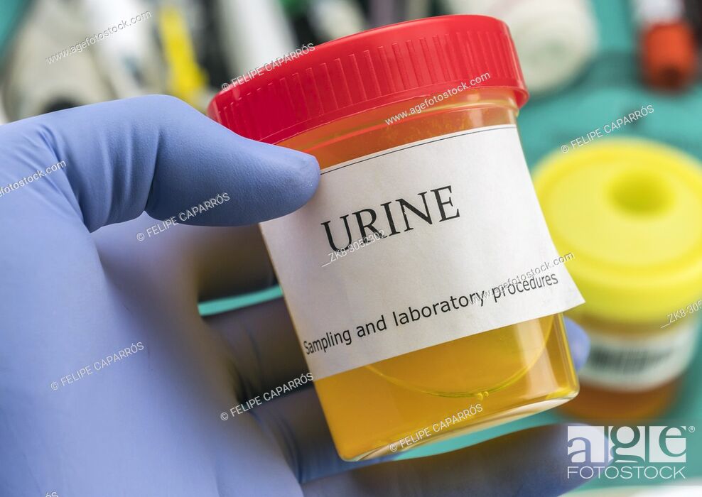 Stock Photo: Doctor working with urine samples in a clinical laboratory.