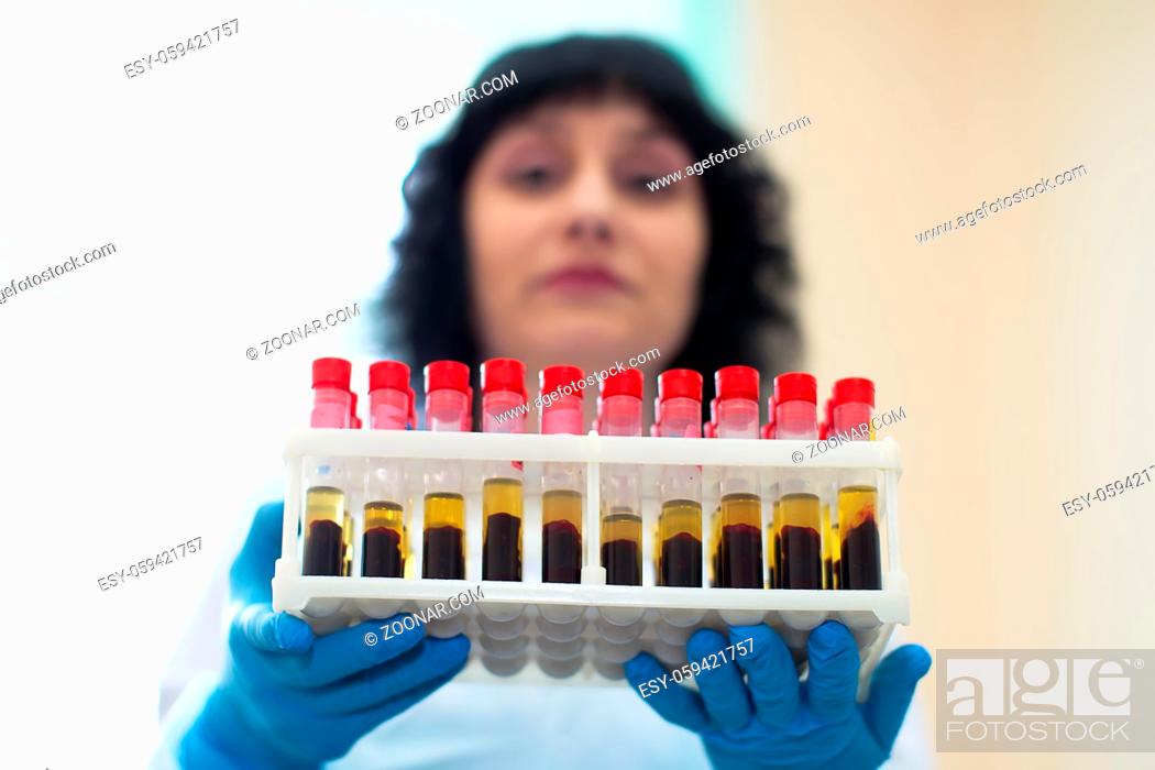 Stock Photo: Belarus, Gomel, 24 April 2018. Blood transfusion station.Nurse with blood tests.Blood in test tubes.
