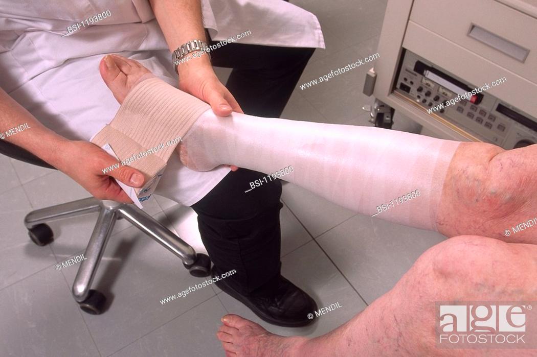 Stock Photo: TREATMENT FOR A VARICOSE VEIN<BR>Fixing bandage to fight off blood accumulation in the legs and prevent phlebitis or ulcer.