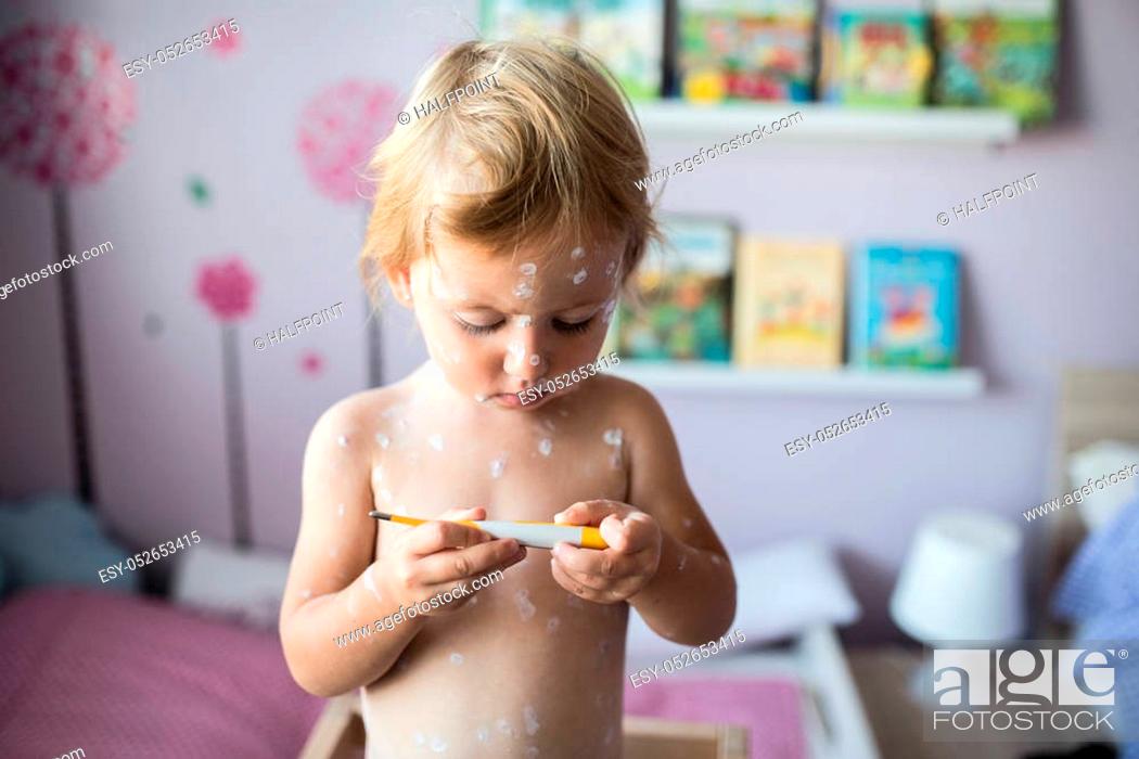 Stock Photo: Beautiful little two year old girl at home sick with chickenpox, white antiseptic cream applied to the rash. Holding thermometer, looking at temperature.