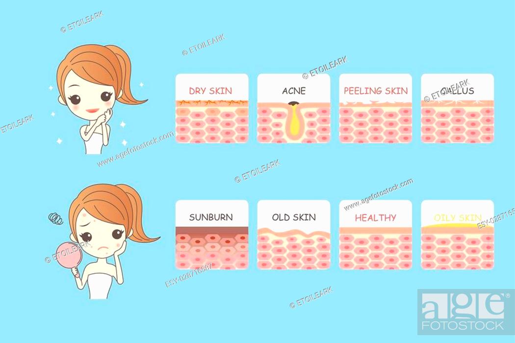 cartoon girls face problem, great for your design, Stock Vector, Vector And  Low Budget Royalty Free Image. Pic. ESY-028716587 | agefotostock