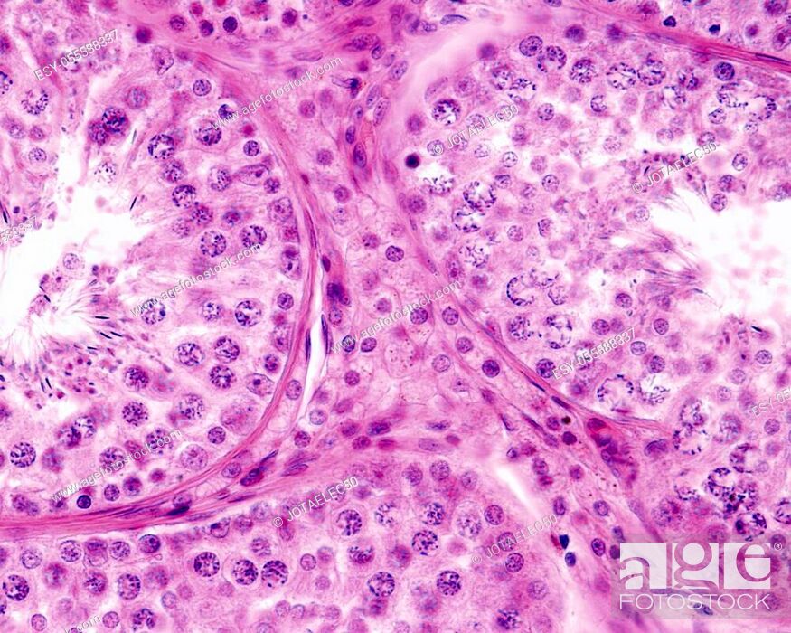 Stock Photo: Interstitial or Leydig cells located in the connective tissue among seminiferous tubules. They are polyhedral epithelioid cells with a single round nucleus and.