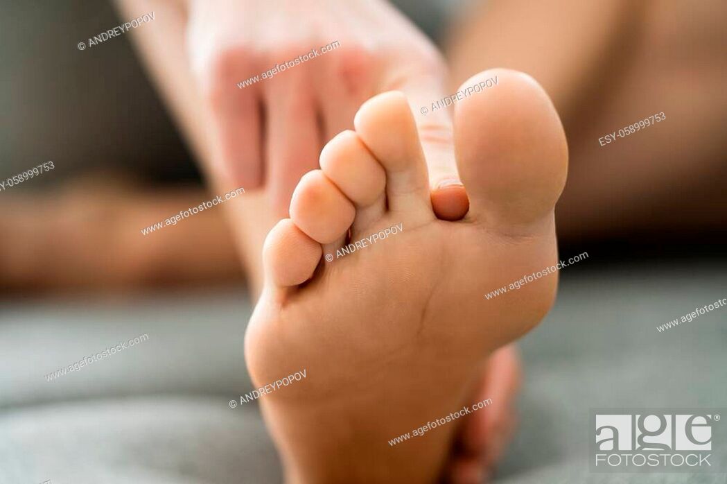 Stock Photo: Athlete Foot Fungal Infection. Itching Between Toes.