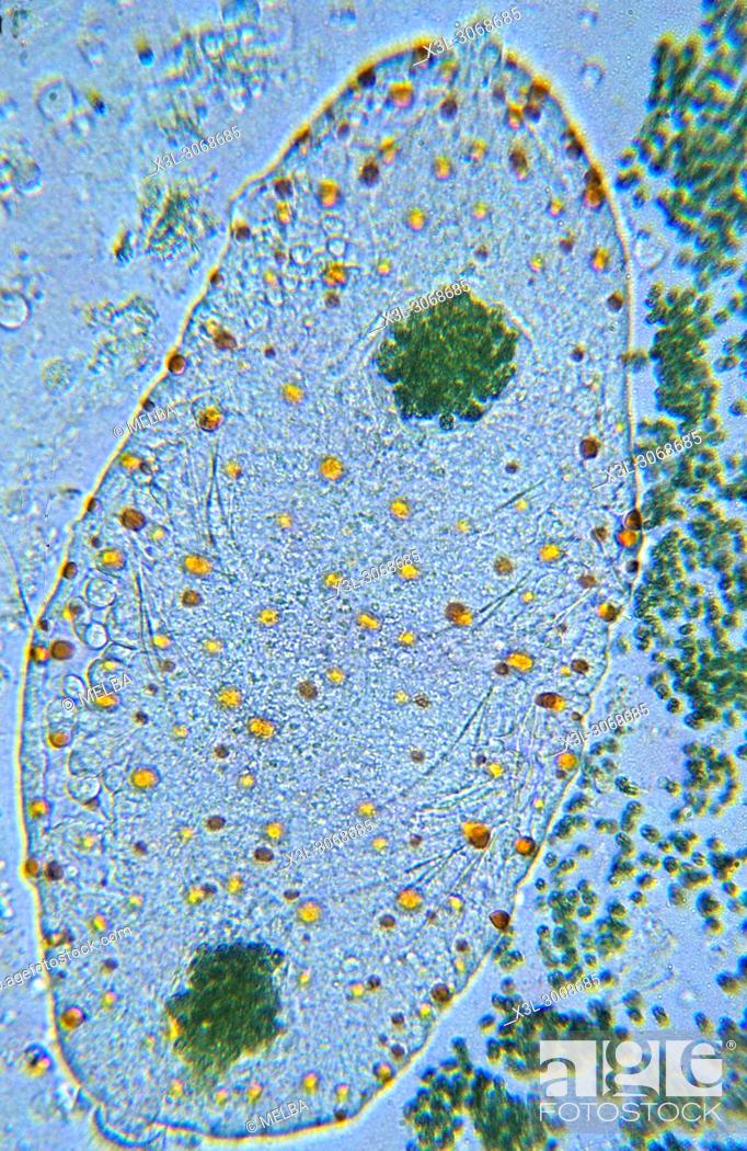 Stock Photo: Amoeba. Pelomyxa sp. Rhizopoda. Protozoans. Optic microscopy.